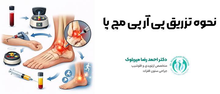 نحوه تزریق پی آر پی مچ پا