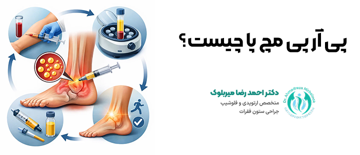پی آر پی مچ پا چیست؟