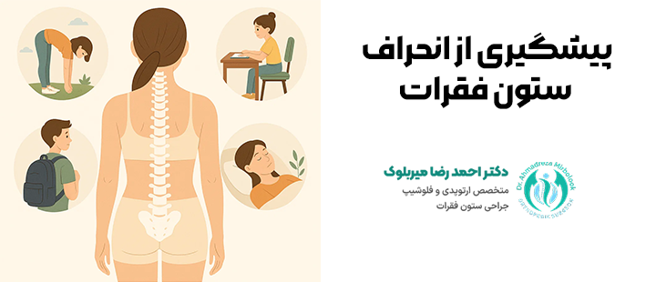 پیشگیری از انحراف ستون فقرات