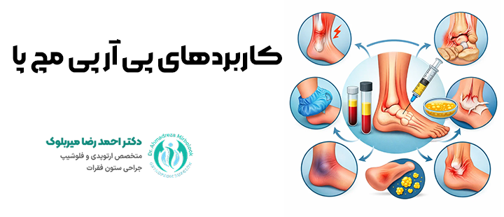 کاربردهای پی آر پی مچ پا