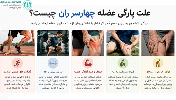 علت پارگی عضله چهارسر ران