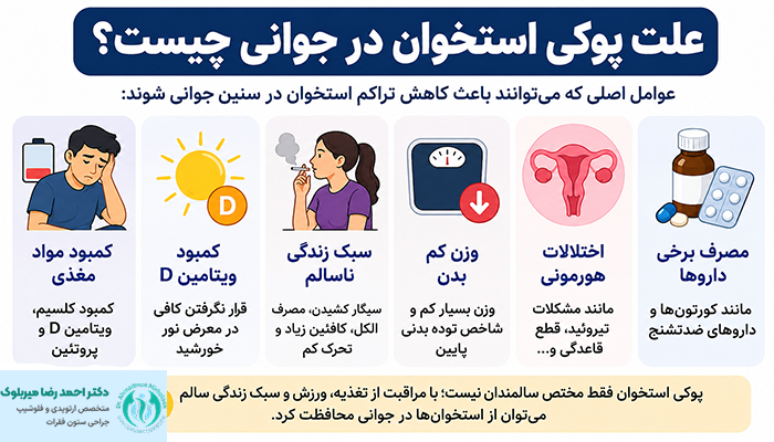 علت پوکی استخوان در جوانی