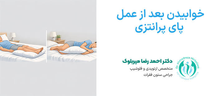 خوابیدن بعد از عمل پای پرانتزی