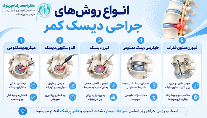 انواع روش های جراحی دیسک کمر