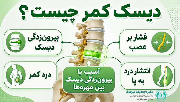 دیسک کمر چیست؟