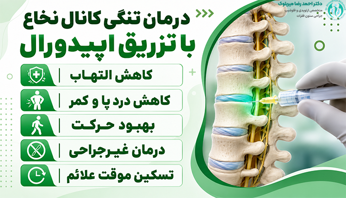 تزریق اپیدورال برای تنگی کانال نخاعی