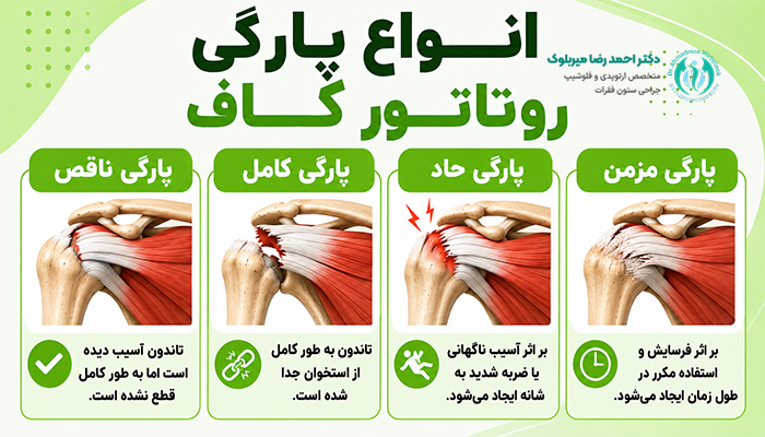 انواع پارگی تاندون روتاتور کاف