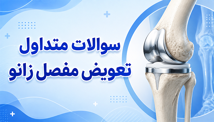 سوالات متداول تعویض مفصل زانو